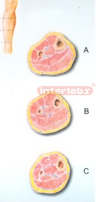 HUMAN TRANSVERSE SECTION THROUGH THE DISTAL 1/3 OF THE RIGHT LEG (A, B, C)